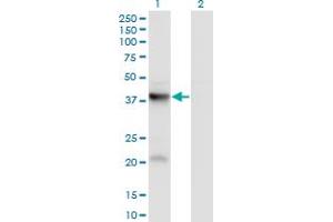 Western Blot analysis of PANK3 expression in transfected 293T cell line by PANK3 monoclonal antibody (M01), clone 3D7. (PANK3 Antikörper  (AA 1-370))