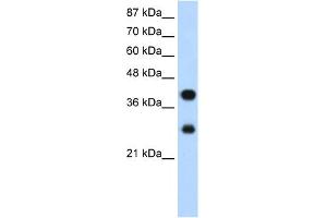 WB Suggested Anti-PCBP2 Antibody Titration:  1. (PCBP2 Antikörper  (Middle Region))