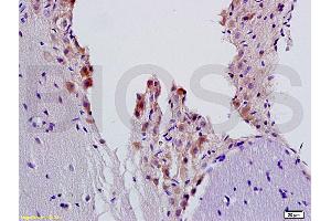 beta 2 Adrenergic Receptor Antikörper  (AA 201-300)