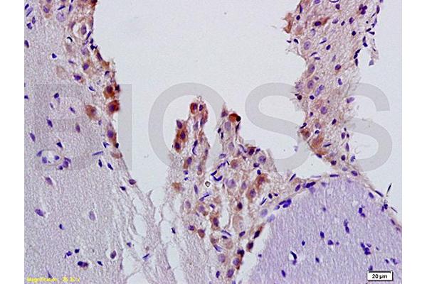 beta 2 Adrenergic Receptor Antikörper  (AA 201-300)