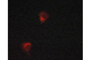 ABIN6268921 staining LOVO cells by ICC/IF. (HSPD1 Antikörper)