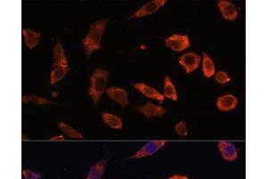 Immunofluorescence analysis of L929 cells using RAB5B Polyclonal Antibody at dilution of 1:100. (RAB5B Antikörper)
