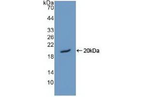 Detection of Recombinant HMGN1, Human using Polyclonal Antibody to High Mobility Group Nucleosome Binding Domain Protein 1 (HMGN1) (HMGN1 Antikörper  (AA 14-100))