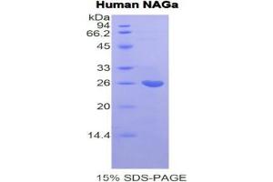 SDS-PAGE analysis of Human NAGa Protein. (NAGA Protein)