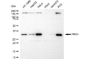 anti-FSHD Region Gene 1 (FRG1) antibody