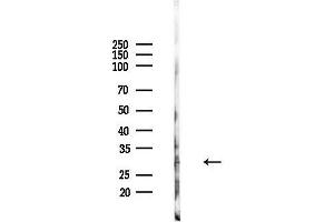 anti-Methylthioadenosine phosphorylase (MTAP) (Internal Region) antibody