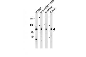 All lanes : Anti-Mouse Csf1r Antibody (C-term) at 1:1000-2000 dilution Lane 1: Mouse heart tissue lysate Lane 2: Mouse skeletal muscle tissue lysate Lane 3: Mouse spleen tissue lysate Lane 4: Rat brain tissue lysate Lysates/proteins at 20 μg per lane.