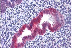 Human Uterus: Formalin-Fixed, Paraffin-Embedded (FFPE) (IDH1 Antikörper  (C-Term))