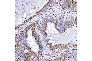 IHC analysis of RAB7/RAB7A using anti-RAB7/RAB7A antibody (ABIN7600597).