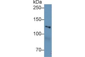 Western Blot; Sample: Human Hela cell lysate; Primary Ab: 1µg/ml Rabbit Anti-Mouse MYO1E Antibody Second Ab: 0. (MYO1E Antikörper  (AA 772-1033))