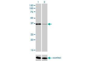 Western blot analysis of PITX1 over-expressed 293 cell line, cotransfected with PITX1 Validated Chimera RNAi (Lane 2) or non-transfected control (Lane 1). (PITX1 Antikörper  (AA 225-313))