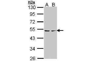 WB Image Sample (30 ug of whole cell lysate) A: Hela B: Hep G2 , 10% SDS PAGE antibody diluted at 1:1000 (PKA 2 beta (Center) Antikörper)