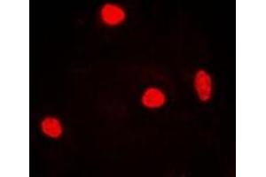 Immunofluorescent analysis of RNF40 staining in MCF7 cells. (RNF40 Antikörper)