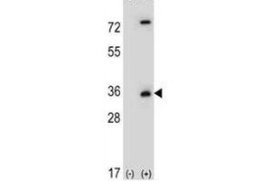 Western Blotting (WB) image for anti-Caspase 3 (CASP3) (AA 149-179) antibody (ABIN3030296)