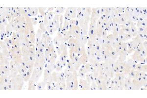 Immunohistochemistry (IHC) image for anti-Solute Carrier Family 2 (Facilitated Glucose Transporter), Member 4 (SLC2A4) (AA 228-292) antibody (ABIN7434539)