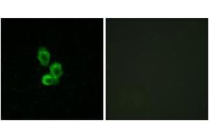 Immunofluorescence analysis of HepG2 cells, using PDGF Receptor beta (Ab-751) Antibody. (PDGFRB Antikörper  (AA 718-767))