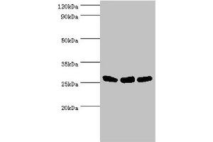 Western blot All lanes: Adenylate kinase 2, mitochondrial antibody at 5 μg/mL Lane 1: Hela whole cell lysate Lane 2: Mouse kidney tissue Lane 3: Mouse small intestine tissue Secondary Goat polyclonal to rabbit IgG at 1/10000 dilution Predicted band size: 27, 26, 23, 15, 25, 22 kDa Observed band size: 27 kDa