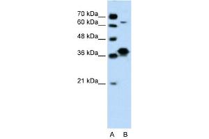 WB Suggested Anti-FOSL1 Antibody Titration: 0. (FOSL1 Antikörper  (Middle Region))