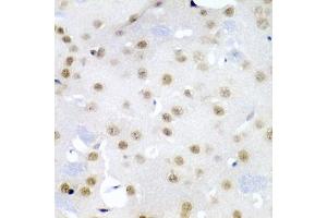 Immunohistochemistry of paraffin-embedded mouse brain using CDC27 antibody (ABIN5975347) at dilution of 1/200 (40x lens). (CDC27 Antikörper)