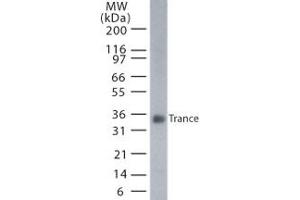 Image no. 1 for anti-Tumor Necrosis Factor (Ligand) Superfamily, Member 11 (TNFSF11) (AA 1-317) antibody (ABIN208247) (RANKL Antikörper  (AA 1-317))