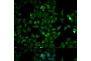 Immunofluorescence analysis of HeLa cells using TPI1 Polyclonal Antibody (TPI1 Antikörper)
