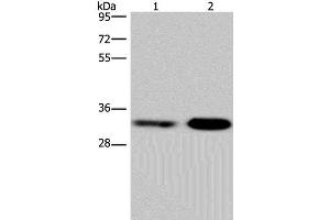 Western Blot analysis of Jurkat and NIH/3T3 cell using CDK5 Polyclonal Antibody at dilution of 1:300 (CDK5 Antikörper)