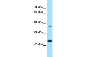 Western Blotting (WB) image for anti-Ependymin Related Protein 1 (Zebrafish) (EPDR1) (N-Term) antibody (ABIN2789381) (EPDR1 Antikörper  (N-Term))