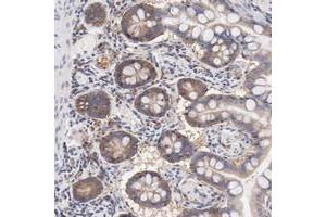 Immunohistochemical staining of human small intestine with SETD3 polyclonal antibody  shows moderate cytoplasmic positivity in glandular cells. (SETD3 Antikörper)