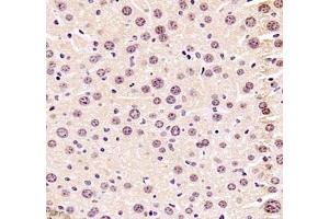 Immunohistochemistry (Paraffin-embedded Sections) (IHC (p)) image for anti-Zinc Finger Protein 307 (ZKSCAN4) antibody (ABIN7076265)