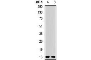 Western blot analysis of Rpp20 expression in MCF7 (A), SW480 (B) whole cell lysates. (POP5 Antikörper)
