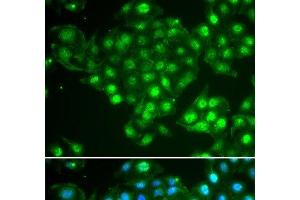Immunofluorescence analysis of HeLa cells using ABCA3 Polyclonal Antibody (ABCA3 Antikörper)