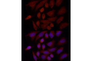 Immunofluorescence analysis of HeLa cells using SREBF1 Rabbit pAb (ABIN7270598) at dilution of 1:100 (40x lens). (SREBF1 Antikörper  (AA 1-100))