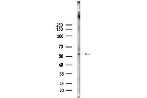 anti-Cholinergic Receptor, Nicotinic, beta 4 (Neuronal) (CHRNB4) (Internal Region) antibody