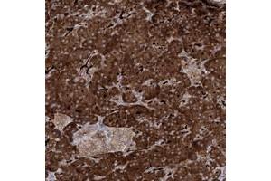 Immunohistochemical staining of human pancreas with ALG9 polyclonal antibody  shows strong cytoplasmic positivity in exocrine glandular cells.