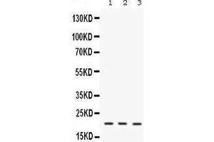 Western blot analysis of IL7 expression in mouse brain extract (lane 1), mouse thymus extract (lane 2) and NIH3T3 whole cell lysates (lane 3). (IL-7 Antikörper  (AA 26-154))
