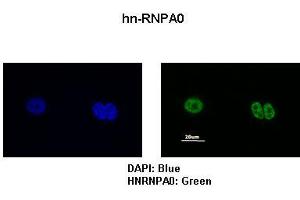 Sample Type :  MCF7 cells   Primary Antibody Dilution :   1:200   Secondary Antibody:  Anti-rabbit-FITC   Secondary Antibody Dilution:   1:500   Color/Signal Descriptions:  DAPI: Blue hn-RNPA0: Green   Gene Name:  HNRPA0   Submitted by:  Anonymous (HNRNPA0 Antikörper  (Middle Region))