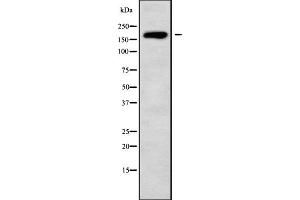 Western blot analysis HECW1 using K562 whole cell lysates. (HECW1 Antikörper)