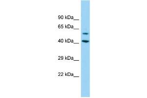 Host: Rabbit Target Name: DEPDC1B Sample Type: 293T Whole Cell lysates Antibody Dilution: 1. (DEPDC1B Antikörper  (N-Term))