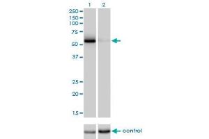 Western Blotting (WB) image for anti-Cell Division Cycle 25 Homolog C (S. Pombe) (CDC25C) (AA 21-130) antibody (ABIN598558) (CDC25C Antikörper  (AA 21-130))