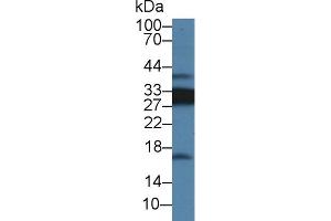 Detection of CD74 in Rat Spleen lysate using Polyclonal Antibody to Cluster Of Differentiation 74 (CD74) (CD74 Antikörper  (AA 65-277))