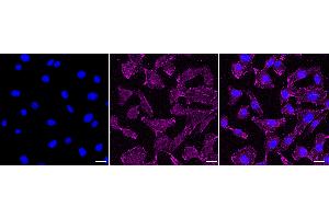 anti-Elongator Acetyltransferase Complex Subunit 4 (ELP4) antibody