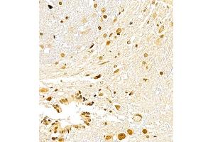 Immunohistochemistry of paraffin embedded rat spinal cord using USP27 (ABIN7076113) at dilution of 1:700 (400x lens) (USP27X Antikörper)