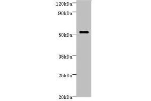 Western blot All lanes: STARD3 Antibody at 6 μg/mL + MCF-7 whole cell lysate Secondary Goat polyclonal to rabbit IgG at 1/10000 dilution Predicted band size: 51, 49, 50 kDa Observed band size: 51 kDa (STARD3 Antikörper  (AA 170-445))