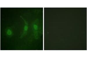 Immunofluorescence analysis of HeLa cells, using IRF-3 (Phospho-Ser385) Antibody. (IRF3 Antikörper  (pSer385))