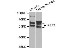 Western blot analysis of extracts of various cell lines, using IKZF3 Antibody (ABIN4904027) at 1:1000 dilution.