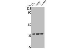 Western Blot analysis of NIH-3T3 HuvEc Jurkat cells using MAGE-C2 Polyclonal Antibody (MAGEC2 Antikörper  (Internal Region))