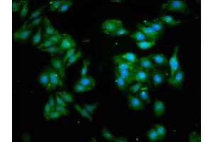Immunofluorescence staining of HepG2 cells with ABIN7153511 at 1:93, counter-stained with DAPI. (GABARAP Antikörper  (AA 2-117))