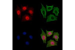 Anillin Antibody staining HepG2 cells by IF/ICC. (Anillin Antikörper  (C-Term))