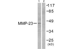 Western Blotting (WB) image for anti-Matrix Metallopeptidase 23 (MMP23) (C-Term) antibody (ABIN1848685) (Matrix Metallopeptidase 23 (MMP23) (C-Term) Antikörper)