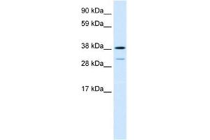 Human Lung; WB Suggested Anti-TCFL1 Antibody Titration: 0. (VPS72 Antikörper  (Middle Region))